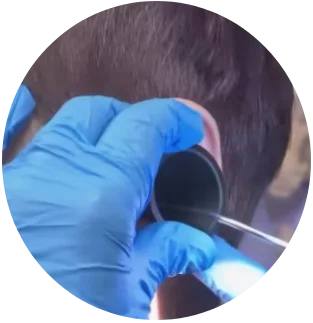 Earwax Microsuction Image